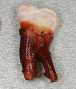 Зубы в газ-воде: шокирующие опыты дантистов